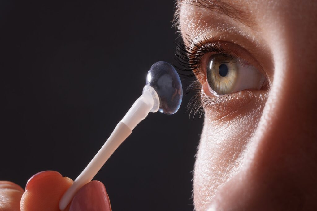 Primer plano de un ojo con lente de contacto tórico.