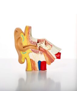 Representación técnica de la degeneración de las células ciliadas en el oído interno por causa de la presbiacusia.